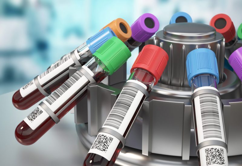 Multiple blood sample vials rotate in a centrifuge within a clean laboratory environment. This process separates components for accurate testing and analysis. 3D illustration.