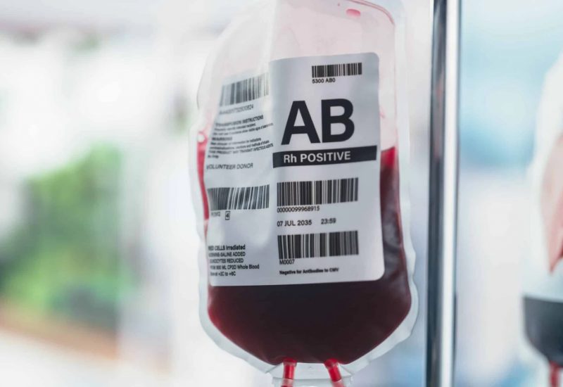 isbt-128-blood-bag-example-scaled (1)