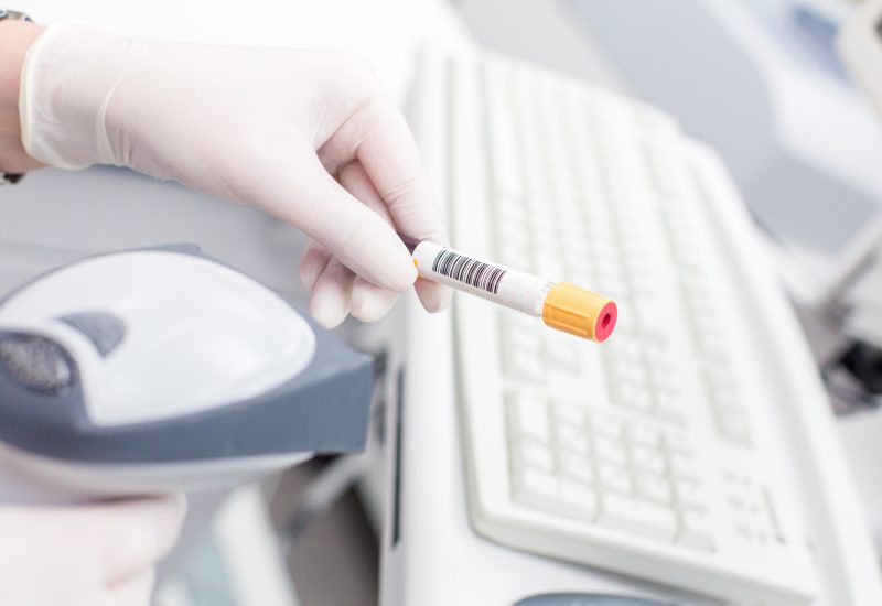 Scanning the bar code on the tube in white medical lab by nurse in white rubber gloves. In the background is a computer keyboard with the mouse. In the foreground a laser barcode scanner.