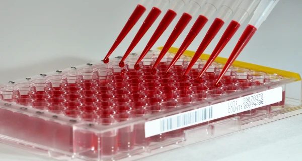 barcoded-plate-rec