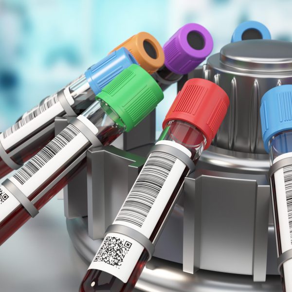 Multiple blood sample vials rotate in a centrifuge within a clean laboratory environment. This process separates components for accurate testing and analysis. 3D illustration.
